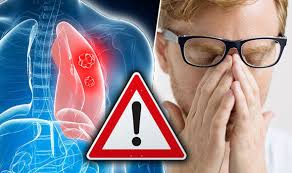 Lung cancer is the type of cancer that basically caused by the mutation in the dna.so, when the cells divide, they will also form the identical cells, so that it enables the body to renew itself. Cancer Symptoms Dizziness Or Feeling Dizzy Could Be Signs Of Lung Cancer Express Co Uk
