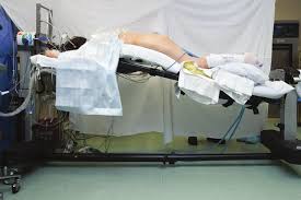 Trendelenburg position is one with the feet higher than the head. Photograph Of Reverse Trendelenburg Prone Positioning Maximal Reverse Download Scientific Diagram