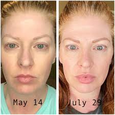 Vitamin C face products for over 40 skin