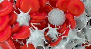 It seems to develop from a combination of genetic and environmental factors. Blood Cancer Journal