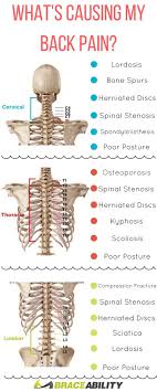 How is that they can sleep in totally unnatural positions and still sleep just fine? Pin On Back Injuries Spine Disorders What S Causing My Back Pain Lower Middle Upper Back Problems