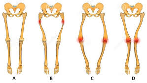 Maybe you would like to learn more about one of these? Soal Ipa Sd Organ Gerak Manusia Tulang Otot Jawaban Muttaqin Id