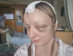 I sang opera while surgeons removed my brain tumour