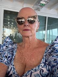 accepting natural appearance at 70