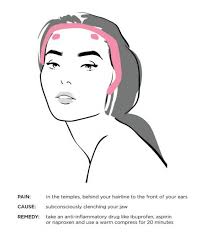 Gps For Your Headaches Location In The Temples From Behind The Hairline Down To The Your Ears Backpain Headache Headache Types Tinnitus Remedies