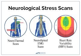 Image result for Autonomic Dysfunction