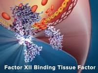Although screenings for prostate cancer are one tool for early detecti. Prostate Cancer Diagnosis And Staging