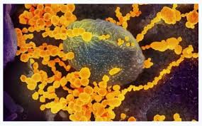 Bearded dragon has yellow skin and other symptoms. Gqf3kb3cnvd0am