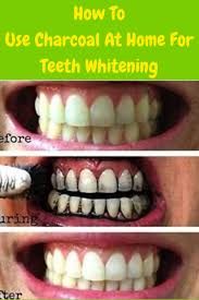 Pin On Homemade Whitening Of Teeth