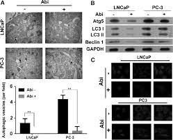 Inhibition of Autophagy Improves the Efficacy of Abiraterone for the  Treatment of Prostate Cancer | Cancer Biotherapy and Radiopharmaceuticals