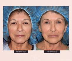 You asked, and we're delivering! 🗞️🧬 The study that formed the foundation  of @xomdskin exceeded our expectations. We anticipated improvements in skin  quality and mood…but we were exceptionally surprised and a bit