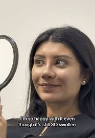 It’s so cute😭 I have been insecure about my nose for my whole life and  started looking at getting a nose jobs about 10 years ago. Dr. Bellamy at  Estetica Institute of the Palm Beaches in west Palm is ...