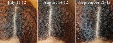 Grow your hair fast ! 1 Month Wild Growth Hair Oil Results