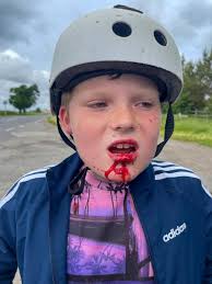 Huge thanks to the lady walking her dog at Eskdale Park