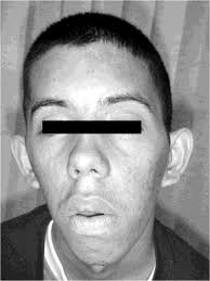 EXAME NEUROLÓGICO EM 15 MINUTOS