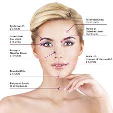 Dysport is said to dysport is also said to diffuse (spread) more quickly, making it a better option for areas like crow's feet which fan out over a larger area on the face. Botox Dysport Fillers And Kybella Monarch Cosmetic Md