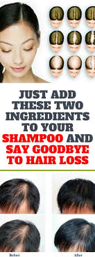 Just Add These Two Ingredients To Your Shampoo And Say Goodbye To Hair Loss Forever What Causes Hair Loss Natural Hair Loss Treatment Hair Loss Shampoo