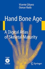 Https Www Chospab Es Biblioteca Documentos Atlas Of Hand Bone Age Pdf