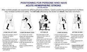 Correct Posture Lying On Hemiplegic Side Neurology