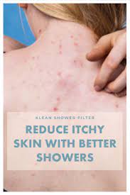hard water 101 how water affects your skin and hair skin problem solution itching skin skin