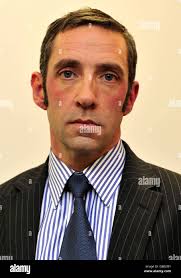 Who was shot in head in hi-res stock photography and images