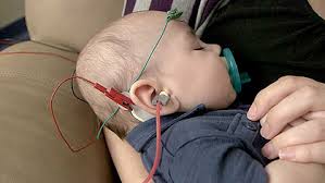 Image result for Pediatric Auditory Screening