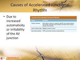 An accelerated junctional rhythm (rate >60) is a narrow complex rhythm that often supersedes a clinically bradycardic sinus node rate (see images below). Ppt Junctional Dysrhythmias Powerpoint Presentation Free Download Id 3359517