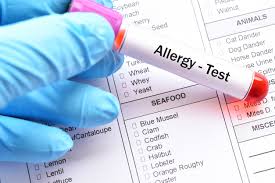 Image result for Allergy Screening