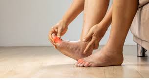 Image result for gout symptoms toe