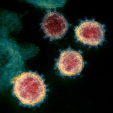 A coronavirus is a common virus that causes an infection in your nose, sinuses, or upper throat. Covid 19 Das Wissen Wir Zum Coronavirus Sars Cov 2 Alles Zu Schutzmassnahmen Symptomen Und Inkubationszeit Wissen
