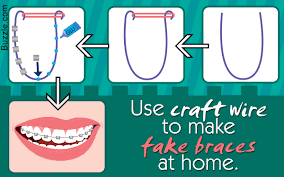 According to the american association of orthodontics, 13 percent of their members have seen patients who attempted diy braces that ended in disaster. Diy Guide On How To Make Fake Braces That Look Real Craft Cue
