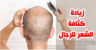 مِن المشاكل الكبيرة الَّتي واجَهَتْني مع زوْجي رغبتُه في أن أنتِف الشَّعر الظَّاهر في الأماكِن الحرِجة من عورتي، وللأسَف حاولتُ كثيرًا، ولكنِّي لم أنْجح في الأمر كما يُحبُّ ويُريد زوْجي، وصارت هذه مشكلة دائمة، هو يطلب منِّي أن أنتِف ولا أُبقي أيَّ شعر في القِسم السفلي من الأمام والخلف. Ø£Ù‡Ù… 10 Ø®Ø·ÙˆØ§Øª Ù„Ø²ÙŠØ§Ø¯Ø© ÙƒØ«Ø§ÙØ© Ø§Ù„Ø´Ø¹Ø± Ù„Ù„Ø±Ø¬Ø§Ù„ Ø«Ù‚Ù Ù†ÙØ³Ùƒ