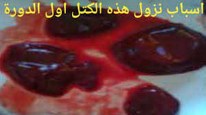 هناك العديد من النساء التي لا تعرفن ما هو الحمل الغزلاني ؟ وماهي الاسباب التي تتسب يشيع بين النساء أن الدم الذي يصحب حملهن في شهوره الأولى هو دم الحيض وذلك نظرا لأن أول أعراض الحمل الغزلاني هو عدم توقف نزول دم الدورة الشهرية بعد حدوث الحمل،غير أن الدم في. Ø§Ù„Ø·Ø§Ø¦Ø±Ø© Ø§Ø´Ù„ÙŠ ÙÙˆØ±Ù…Ø§Ù† ØªØ¯Ø§Ø®Ù„ ØªÙƒØªÙ„ Ø¯Ù… Ø§Ù„Ø¯ÙˆØ±Ø© Show Shots Com