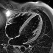 Magnetresonanztomographie mrt kernspintomographie 030.889 20 50 am kurfürstendamm 37, 030.889 20 5 21 termine mrt privat. Home Rns Herz Diagnostik