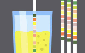 The Lowly Urinalysis How To Avoid Common Pitfalls