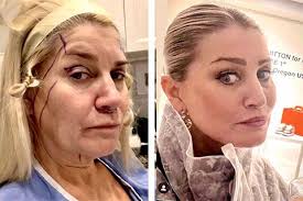 millie lopez (nlite24)