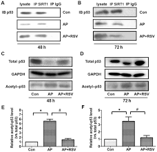 Pancreatic enzyme levels in blood, urine, or ascitic ﬂ uid. Resveratrol Protects Against L Arginine Induced Acute Necrotizing Pancreatitis In Mice By Enhancing Sirt1 Mediated Deacetylation Of P53 And Heat Shock Factor 1
