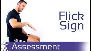 Quick movement (as of the fingers); Flick Sign Carpal Tunnel Syndrome Youtube