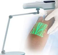 Amazon.com: Vascular Vein Viewer,Led Vein Finder,Vein ...