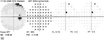 Snellen Chart An Overview Sciencedirect Topics