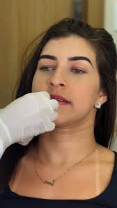 Por aqui estamos sem palavras!! Qual nota vocês dão para esse resultado?,  ., ., ., ., ., #preenchimentolábial #labios
