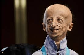 Sabías que el personaje de Benjamin Button existió en la vida real?