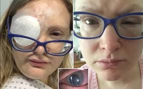 Cô gái bị 4 con ong chui vào mắt để... hút nước mắt