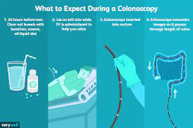 Print this chart (pdf) for easy reference. Colonoscopy Overview