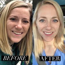 What order should you follow for skincare?