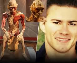 Mother recognizes son's body in Las Vegas anatomical exhibit