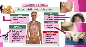 Ecco quali sono i cibi che dovreste evitare con questa la sindrome dell'ovaio policistico (pcos) è un disturbo che comporta uno squilibrio degli ormoni sessuali, causando problemi come colesterolo. Sindrome Dell Ovaio Policistico E Dieta Dietista Dott Ssa Alice Gelmetti