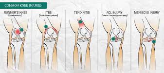 The health care provider will do a physical exam that includes pressing on the knee and legs and moving them in certain ways. Running Into Knee Injuries Eastern Idaho Regional Medical Center Idaho Falls Id