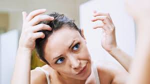 Dandruff is not caused by dry skin. 7 Tips To Treat Dandruff Right Now Everyday Health
