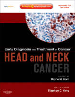 Read on to learn about the types, their symptoms, and treatment. Early Diagnosis And Treatment Of Cancer Series Head And Neck Cancers Sciencedirect